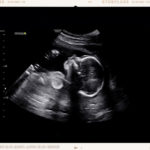 Baby Taylor Ultrasound | Word for 2022